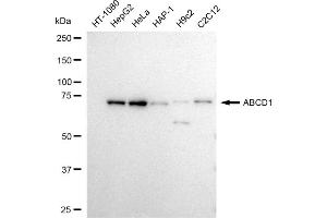 Western blotting analysis using ABCD1 antibody (ABIN7797686). (Rekombinanter ABCD1 Antikörper)