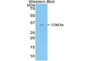 Western Blotting (WB) image for anti-Growth Factor Receptor-Bound Protein 7 (GRB7) (AA 66-327) antibody (ABIN1859067) (GRB7 Antikörper  (AA 66-327))