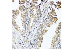 Immunohistochemistry of paraffin-embedded human prostate using STK3 antibody. (STK3 Antikörper)