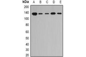 Western blot analysis of PITRM1 expression in A549 (A), MCF7 (B), mouse liver (C), mouse kidney (D), rat heart (E) whole cell lysates.