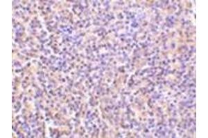 Immunohistochemistry of TCCR in human spleen tissue with this product at 5 μg/ml.