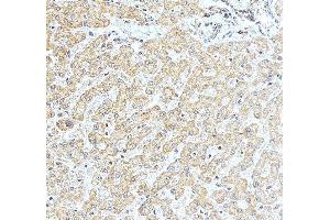 IHC analysis of NOB1 using anti-NOB1 antibody (ABIN7599344). (NOB1 Antikörper  (AA 1-389))