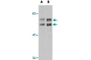 Western blot analysis of JPH2 in mouse brain tissue lysate with JPH2 polyclonal antibody  at (A) 1 and (B) 2 ug/mL . (Junctophilin 2 Antikörper  (C-Term))