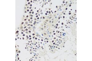Immunohistochemistry of paraffin-embedded mouse testis using Cyclin E2 antibody (ABIN1679046, ABIN3018761, ABIN3018762 and ABIN6220571) at dilution of 1:100 (40x lens). (Cyclin E2 Antikörper  (C-Term))