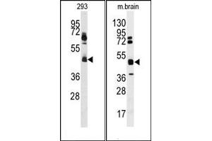 Image no. 1 for anti-Heterogeneous Nuclear Ribonucleoprotein K (HNRNPK) (N-Term) antibody (ABIN358037) (HNRNPK Antikörper  (N-Term))