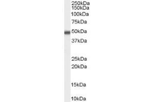 Image no. 1 for anti-Methyl-CpG Binding Domain Protein 2 (MBD2) (Internal Region), (Isoform 1) antibody (ABIN375214) (MBD2 Antikörper  (Internal Region, Isoform 1))