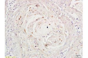 Immunohistochemistry (Paraffin-embedded Sections) (IHC (p)) image for anti-Antigen Identified By Monoclonal Antibody Ki-67 (MKI67) (AA 1201-1300) antibody (ABIN677858)