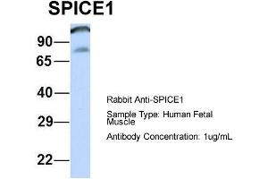 Host: Rabbit  Target Name: SPICE1  Sample Tissue: Human Fetal Muscle  Antibody Dilution: 1. (SPICE1 Antikörper  (Middle Region))
