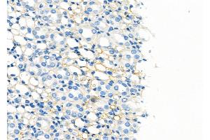 ABIN6260012 and ABIN6279137 at 1/100 staining Rat kidney tissue by IHC-P. (AQP6 Antikörper  (Internal Region))