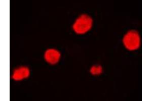 Immunofluorescent analysis of EZH1 staining in HeLa cells. (EZH1 Antikörper  (Center))