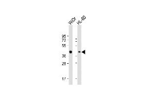 All lanes : Anti-TFB2M Antibody (C-term) at 1:2000 dilution Lane 1: WiDr whole cell lysate Lane 2: HL-60 whole cell lysate Lysates/proteins at 20 μg per lane.