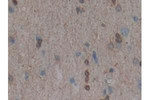 Detection of MAPK11 in Human Cerebrum Tissue using Polyclonal Antibody to Mitogen Activated Protein Kinase 11 (MAPK11)