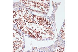 Immunohistochemistry of paraffin-embedded mouse testis using PKCδ antibody (ABIN6128464, ABIN6146203, ABIN6146204 and ABIN6213859) at dilution of 1:100 (40x lens). (PKC delta Antikörper  (AA 477-676))