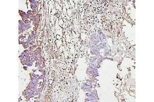 IHC analysis of IRAK1 using anti-IRAK1 antibody (ABIN7603128).