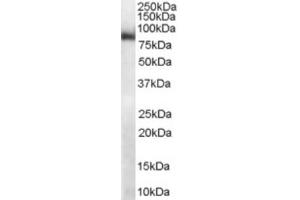 Western Blotting (WB) image for anti-Midline 2 (MID2) (C-Term) antibody (ABIN2465946) (Midline 2 Antikörper  (C-Term))