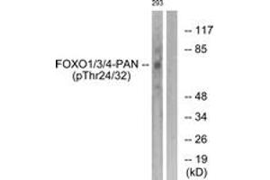 Western blot analysis of extracts from 293 cells treated with Serum 20% 15', using FOXO1/3/4-pan (Phospho-Thr24/32) Antibody. (FOXO1 Antikörper  (pThr24))