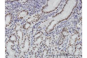 Immunoperoxidase of monoclonal antibody to BRD3 on formalin-fixed paraffin-embedded human stomach. (BRD3 Antikörper  (AA 418-556))