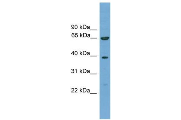KLHL20 抗体  (C-Term)
