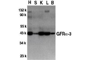 Western Blotting (WB) image for anti-GDNF Family Receptor alpha 3 (GFRA3) (Middle Region) antibody (ABIN1030939)