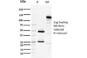SDS-PAGE Analysis Purified ORC1 Mouse Monoclonal Antibody (7F6/1). (ORC1 Antikörper)
