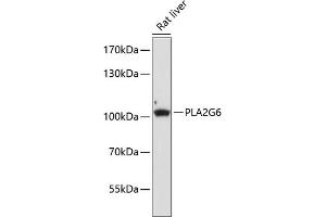 Western blot analysis of extracts of rat liver, using PLG6 antibody (ABIN6134886, ABIN6145732, ABIN6145733 and ABIN6225021) at 1:1000 dilution. (PLA2G6 Antikörper  (AA 550-650))