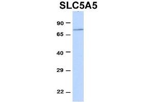 Host:  Rabbit  Target Name:  SLC5A5  Sample Type:  293T  Antibody Dilution:  1. (SLC5A5 Antikörper  (Middle Region))