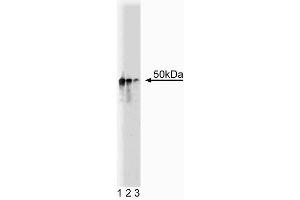 Western blot analysis of Dynactin p50 on Jurkat cell lysate. (Dynamitin Antikörper  (AA 55-196))