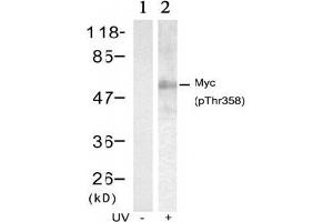 Image no. 2 for anti-Myc Proto-Oncogene protein (MYC) (pThr358) antibody (ABIN196675) (c-MYC Antikörper  (pThr358))
