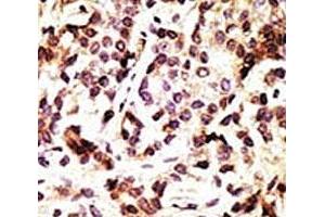 Immunohistochemistry (IHC) image for anti-Beclin 1, Autophagy Related (BECN1) (AA 181-210) antibody (ABIN3030157)
