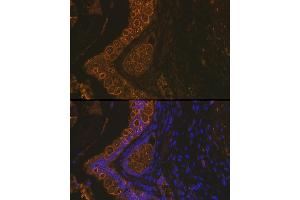 Immunofluorescence analysis of Rat rectum using Cytokeratin 18 (KRT18) antibody (ABIN7268097) at dilution of 1:100. (Cytokeratin 18 Antikörper)