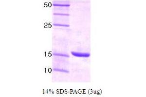 SDS-PAGE (SDS) image for Ubiquitin-Conjugating Enzyme E2I (UBE2I) protein (ABIN666677)