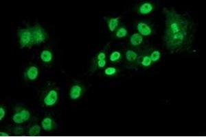 Anti-LOX mouse monoclonal antibody (ABIN2453810) immunofluorescent staining of COS7 cells transiently transfected by pCMV6-ENTRY LOX (RC213323). (LOX Antikörper  (AA 22-168))