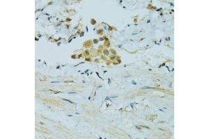 Immunohistochemistry of paraffin-embedded human lung using CYP2B6 antibody. (CYP2B6 Antikörper)