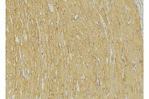 Immunohistochemistry (IHC) image for anti-Tripartite Motif Containing 59 (TRIM59) (Internal Region) antibody (ABIN6259222)