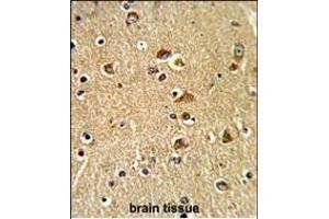 Formalin-fixed and paraffin-embedded human brain tissue reacted with PDIA6 Antibody (Center ), which was peroxidase-conjugated to the secondary antibody, followed by DAB staining. (PDIA6 Antikörper  (AA 236-264))