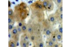 IHC-P analysis of Liver tissue, with DAB staining. (EPYC Antikörper  (AA 110-317))