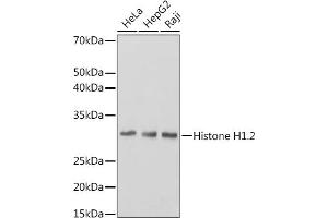 Western blot analysis of extracts of various cell lines, using Histone H1. (HIST1H1C Antikörper)