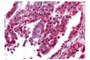 Affinity Purified anti-EGR-1 antibody was used at a 10 ug/ml to detect nuclear and cytoplasmic signal with low background staining in a variety of tissues including multi-human, multi-brain and multi-cancer slides. (EGR1 Antikörper  (AA 85-115))
