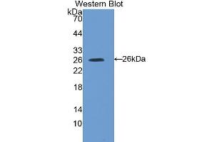 Western Blotting (WB) image for anti-Suppressor of Cytokine Signaling 3 (SOCS3) (AA 1-225) antibody (ABIN3206237) (SOCS3 Antikörper  (AA 1-225))