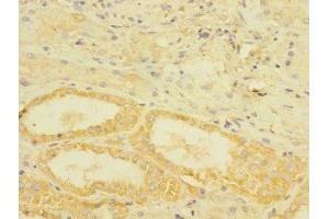 Immunohistochemistry (IHC) image for anti-Transforming Growth Factor, beta Receptor III (TGFBR3) (AA 140-340) antibody (ABIN7172811)