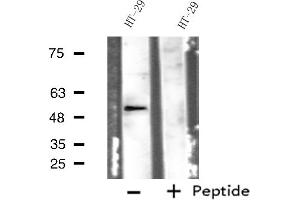Western blot analysis of extracts from HT-29 cells, using ADRB1 antibody. (ADRB1 Antikörper  (Internal Region))
