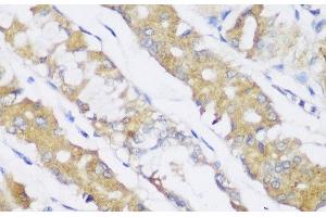 Immunohistochemistry of paraffin-embedded Human stomach using FA2H Polyclonal Antibody at dilution of 1:150 (40x lens). (FA2H Antikörper)