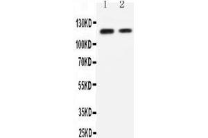 Anti-P cadherin antibody, Western blotting Lane 1: Recombinant Human P-Cadherin Protein 10ng Lane 2: Recombinant Human P-Cadherin Protein 5ng
