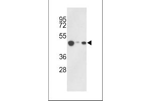 HAT1 Antikörper  (C-Term)