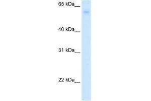 WB Suggested Anti-SLC2A2 Antibody Titration:  0.