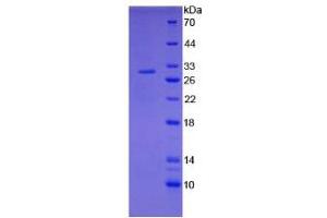 SDS-PAGE analysis of Rat Tissue Factor Protein. (Tissue factor Protein)