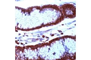 Immunohistochemistry (IHC) image for anti-Baculoviral IAP Repeat-Containing 5 (BIRC5) (N-Term) antibody (ABIN4369171) (Survivin Antikörper  (N-Term))