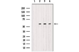 Western blot analysis of extracts from various samples, using OXCT1 antibody. (OXCT1 Antikörper  (Internal Region))