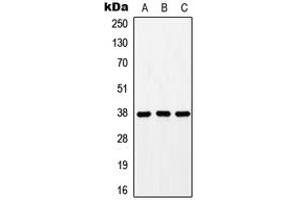 Western blot analysis of GPR171 expression in HEK293T (A), mouse liver (B), rat liver (C) whole cell lysates. (GPR171 Antikörper  (Center))