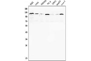 Western blot analysis of Androgen Receptor/AR using anti-Androgen Receptor/AR antibody (ABIN7602200).